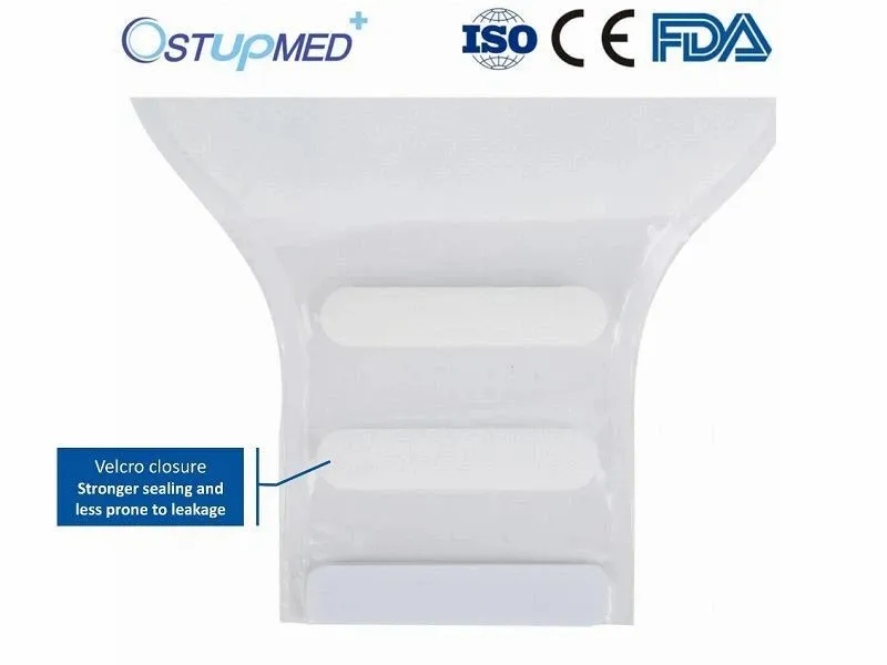 Beg Ostomy Pediatrik